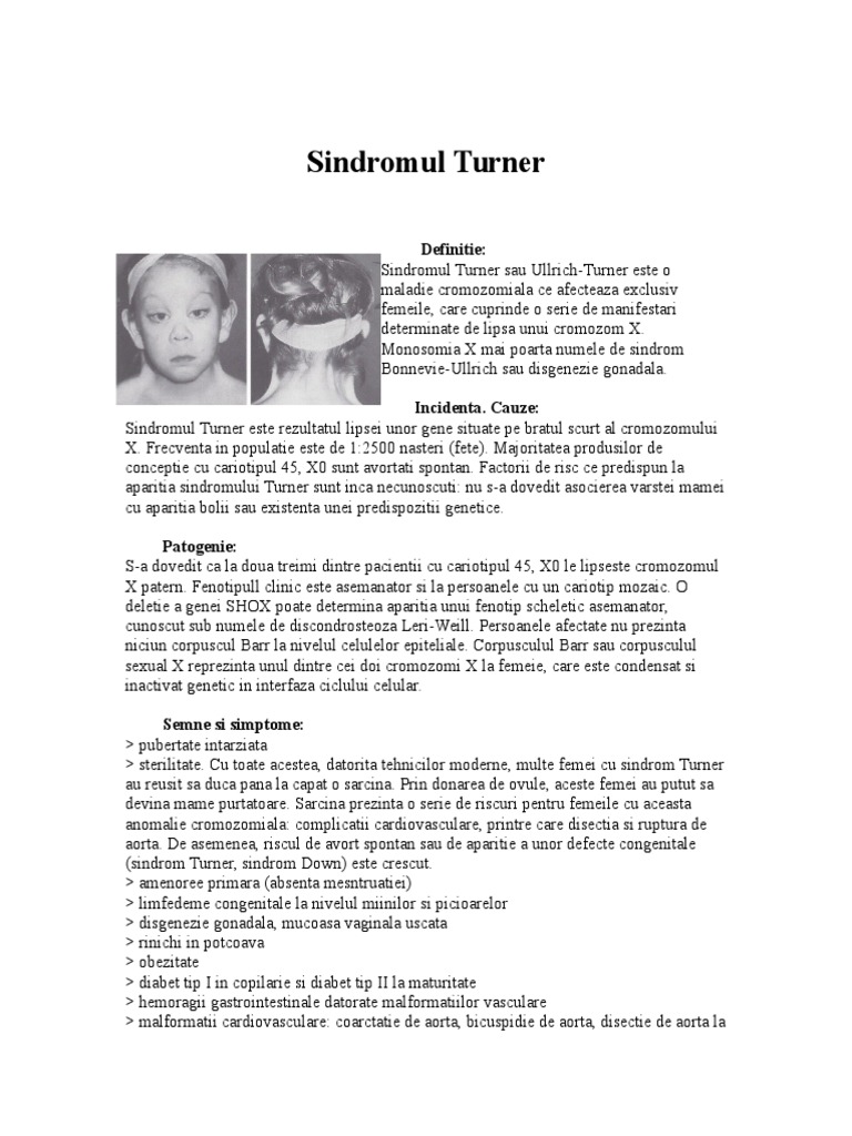 Реферат: Turners Syndrome Essay Research Paper Kalene SzymczakJanuary